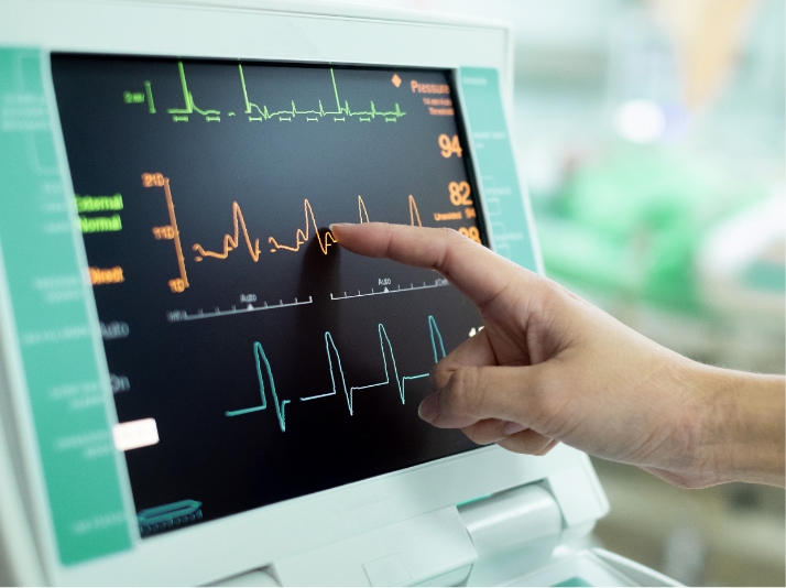 Qu’est-ce qu’un ECG et à quoi sert-il ?