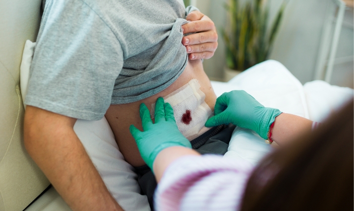 Un service adapté à tous les types de plaies